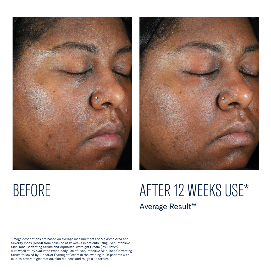 Skinbetter Science Even Tone Correcting Serum