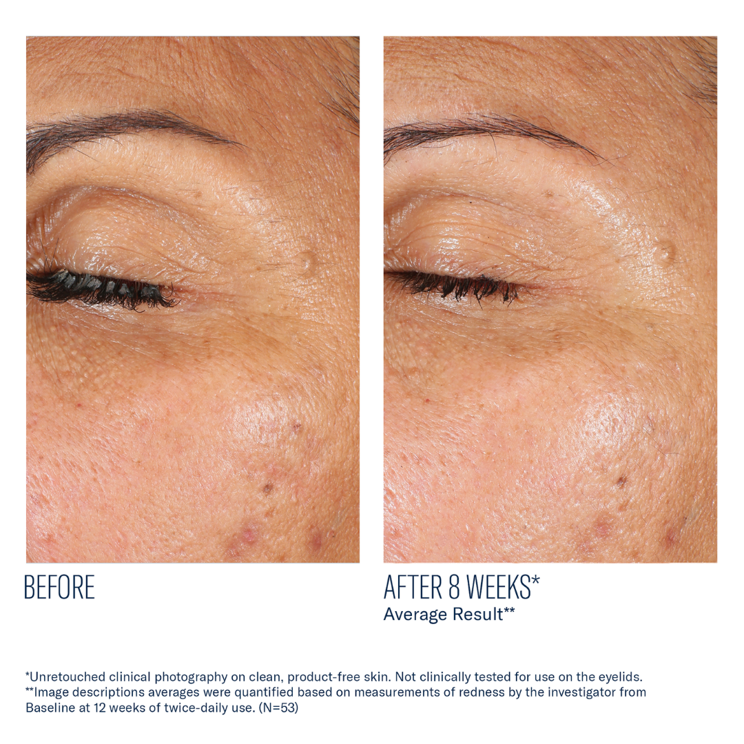Skinbetter Science EyeMax AlphaRet Overnight Cream