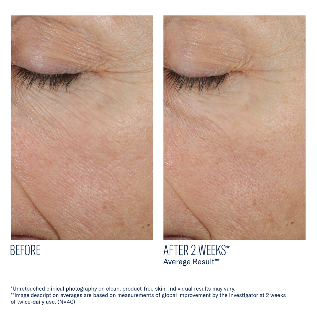 Skinbetter Science Trio Rebalancing Moisturizer